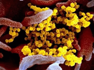 ENCONTRARÍA INVESTIGADOR DE LA UNAM, VACUNA CONTRA CORONAVIRUS